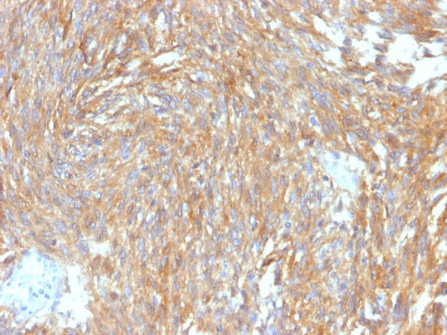 DOG-1/TMEM16A Antibody in Immunohistochemistry (Paraffin) (IHC (P))