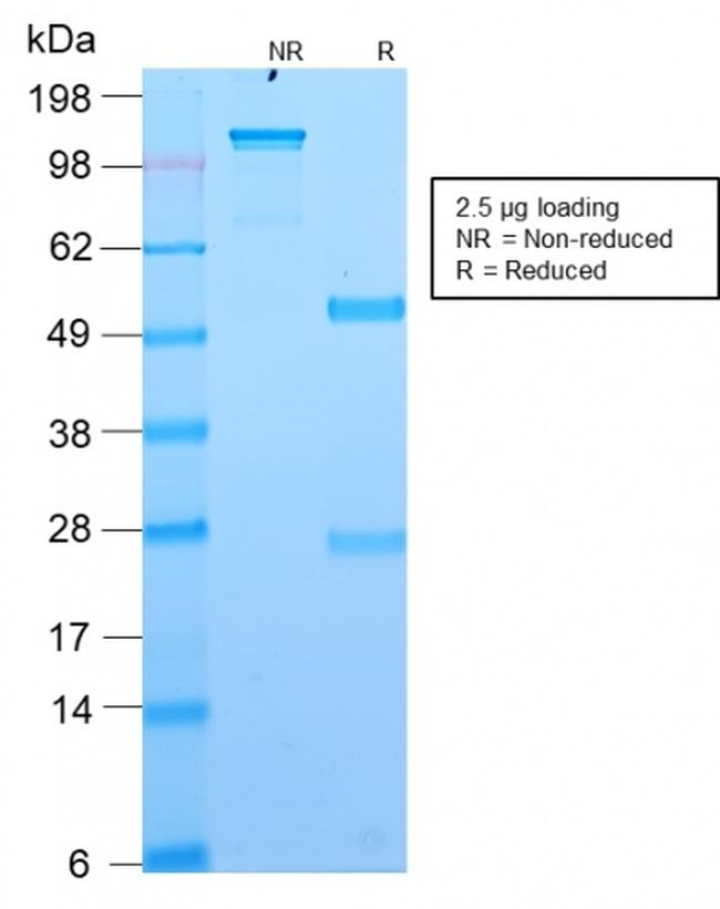 DOG-1/TMEM16A Antibody in SDS-PAGE (SDS-PAGE)