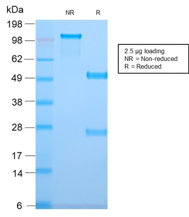 DOG-1/TMEM16A Antibody in SDS-PAGE (SDS-PAGE)