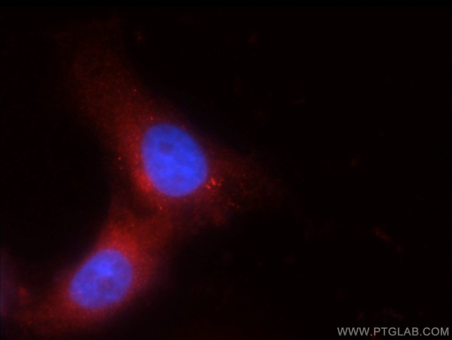 TRPM1 Antibody in Immunocytochemistry (ICC/IF)