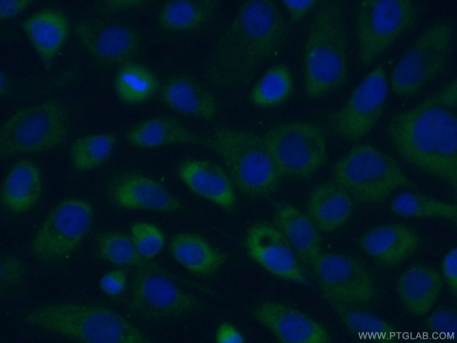 TRPM1 Antibody in Immunocytochemistry (ICC/IF)