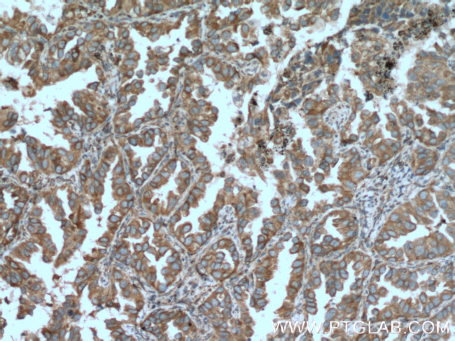 TRPM1 Antibody in Immunohistochemistry (Paraffin) (IHC (P))