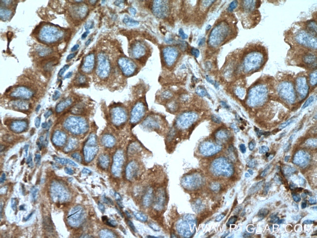 TRPM1 Antibody in Immunohistochemistry (Paraffin) (IHC (P))