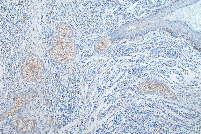 TRPM1 Antibody in Immunohistochemistry (Paraffin) (IHC (P))