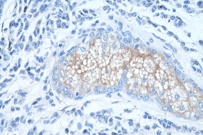 TRPM1 Antibody in Immunohistochemistry (Paraffin) (IHC (P))