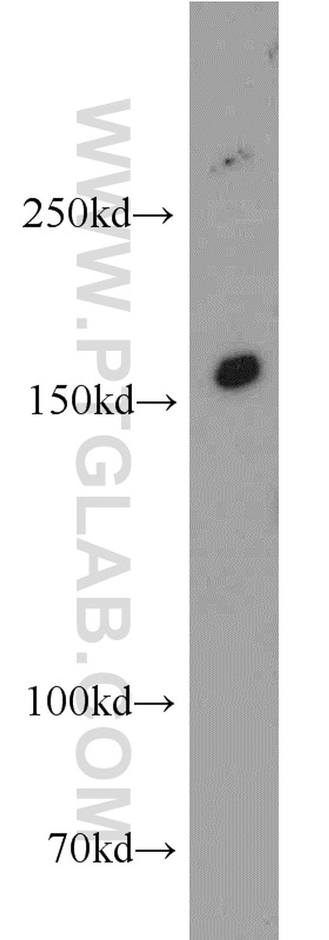 INSRR Antibody in Western Blot (WB)