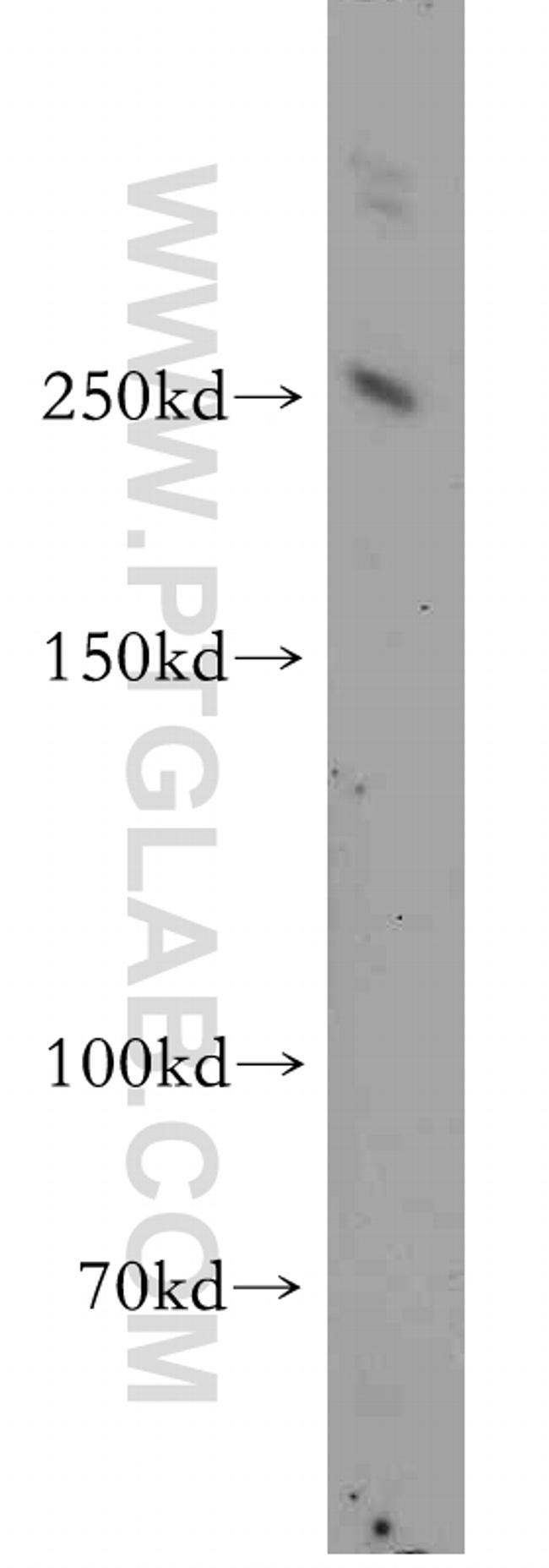 INSRR Antibody in Western Blot (WB)