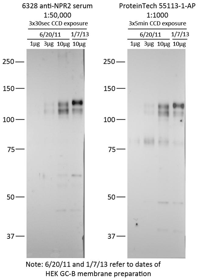 NPR2 Antibody in Western Blot (WB)