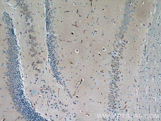 NOTCH3 Antibody in Immunohistochemistry (Paraffin) (IHC (P))