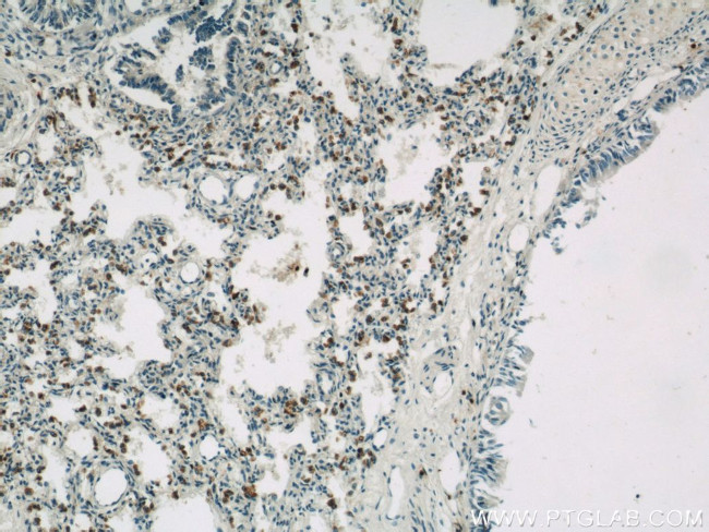 NOTCH3 Antibody in Immunohistochemistry (Paraffin) (IHC (P))