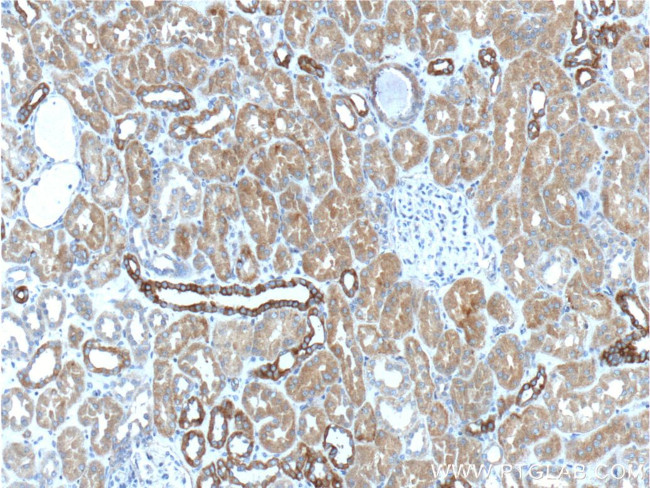 NOTCH3 Antibody in Immunohistochemistry (Paraffin) (IHC (P))