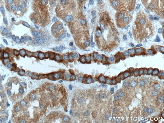 NOTCH3 Antibody in Immunohistochemistry (Paraffin) (IHC (P))