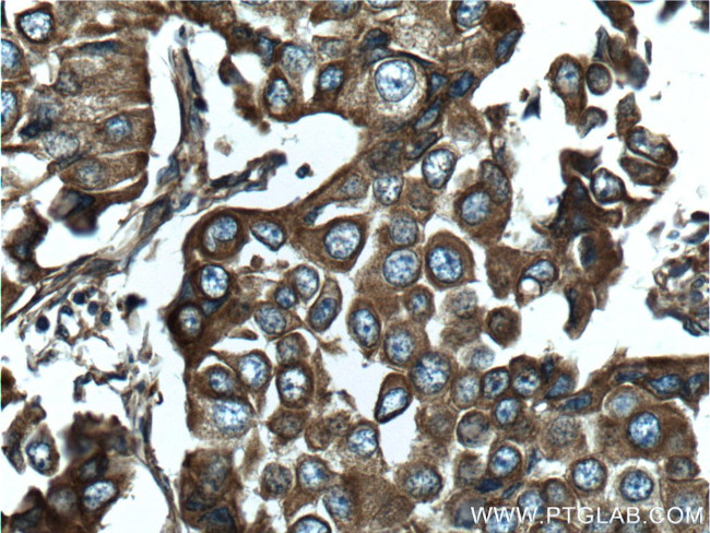 NOTCH3 Antibody in Immunohistochemistry (Paraffin) (IHC (P))