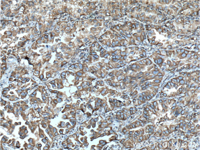 NOTCH3 Antibody in Immunohistochemistry (Paraffin) (IHC (P))