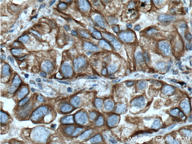 NOTCH3 Antibody in Immunohistochemistry (Paraffin) (IHC (P))