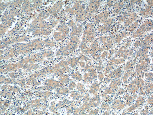 NPR1 Antibody in Immunohistochemistry (Paraffin) (IHC (P))