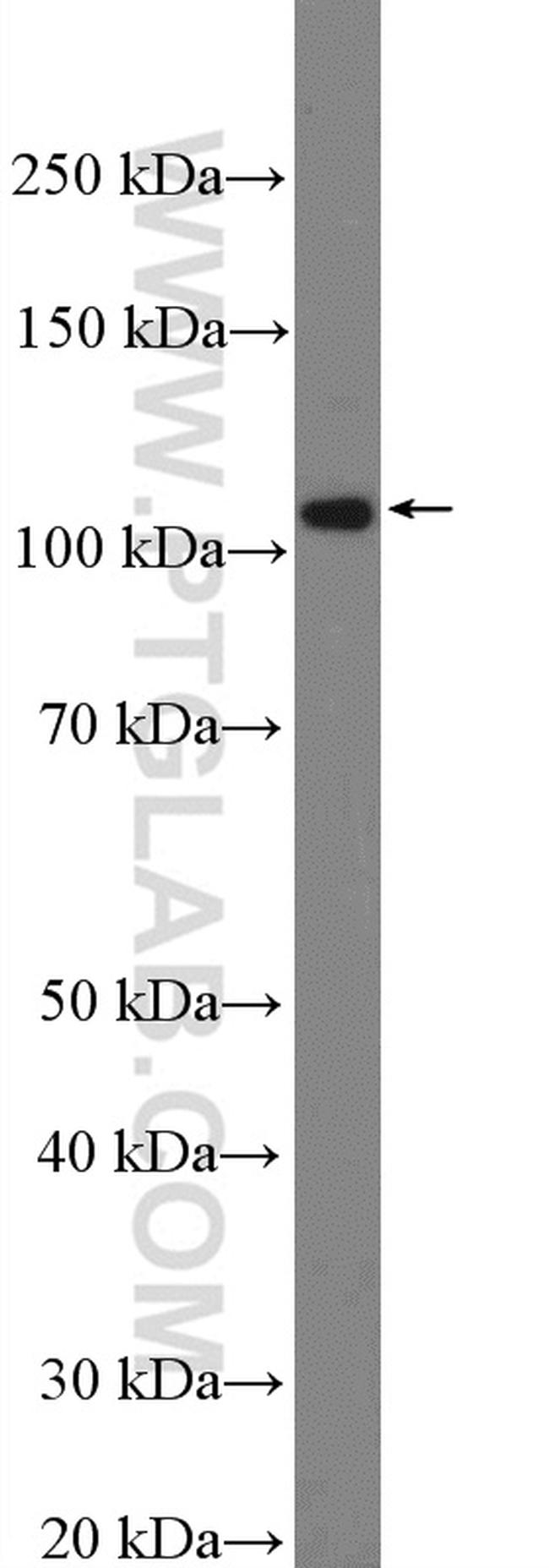 NPR1 Antibody in Western Blot (WB)