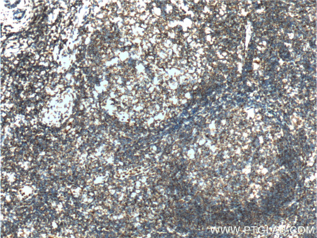 PTPRJ Antibody in Immunohistochemistry (Paraffin) (IHC (P))