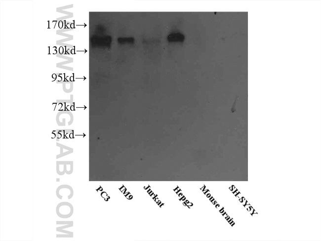 PTPRJ Antibody in Western Blot (WB)