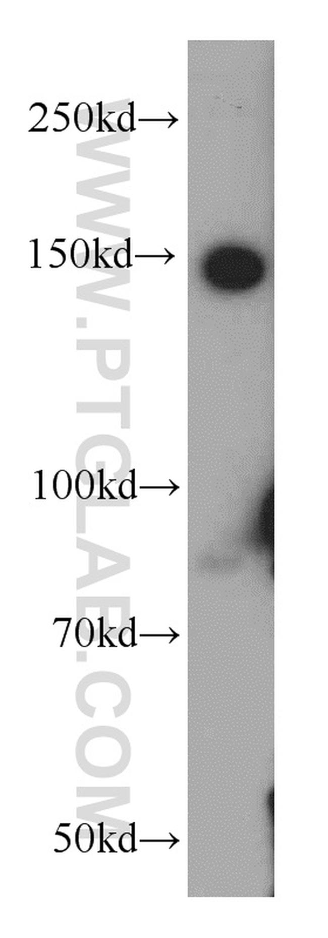 PTPRJ Antibody in Western Blot (WB)