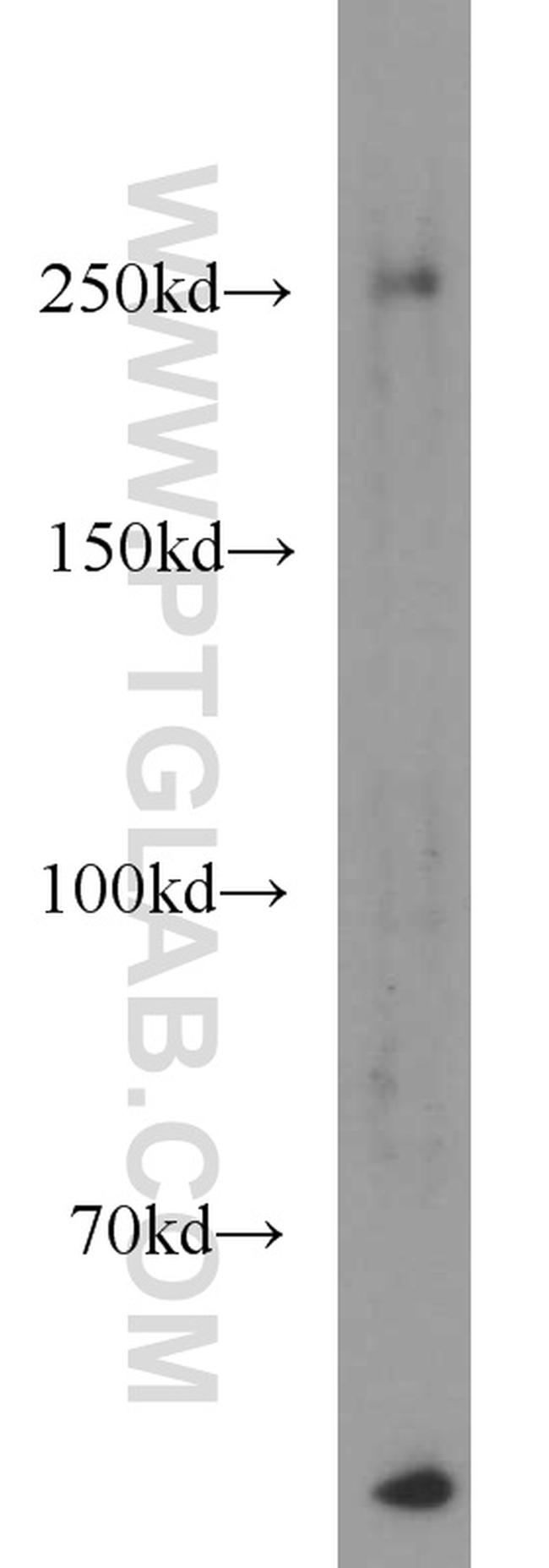 PTPRZ1 Antibody in Western Blot (WB)