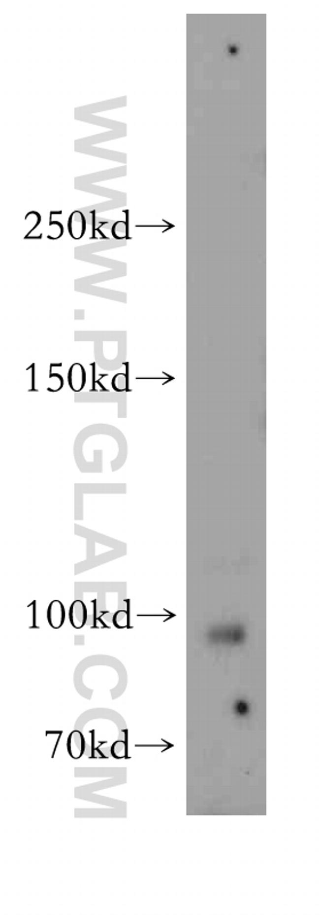 GUCY2D Antibody in Western Blot (WB)