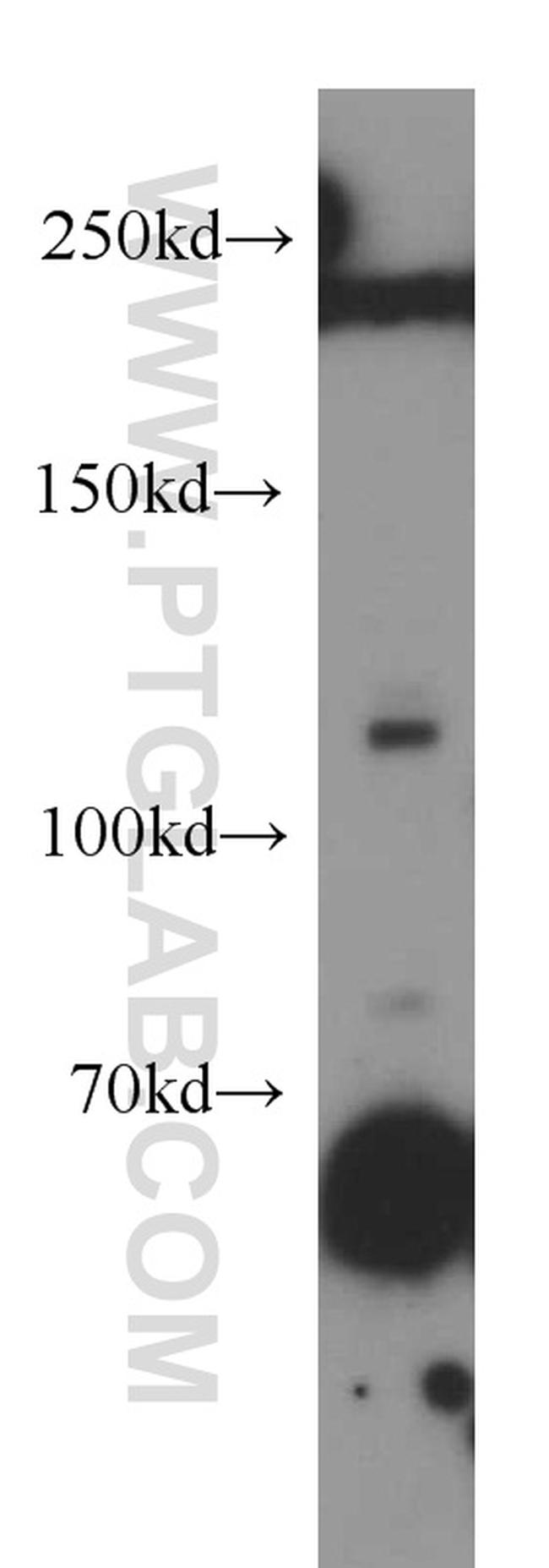 GUCY2D Antibody in Western Blot (WB)