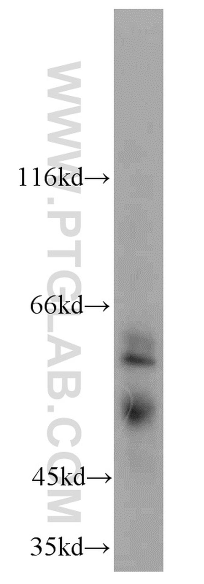 PSAPL1 Antibody in Western Blot (WB)