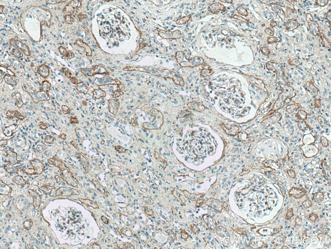 Collagen Type IV Antibody in Immunohistochemistry (Paraffin) (IHC (P))