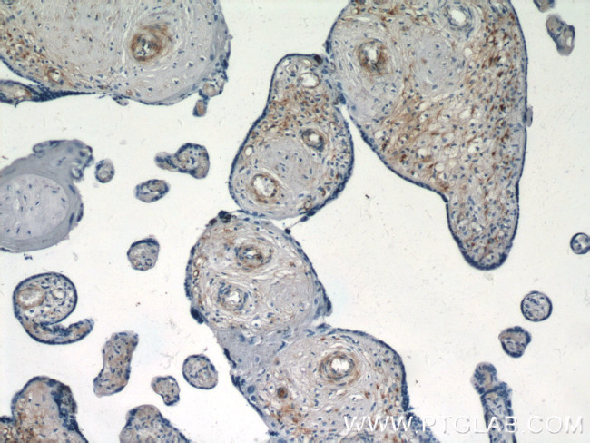 S1PR1/EDG1 Antibody in Immunohistochemistry (Paraffin) (IHC (P))