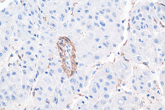 Alpha SMA Antibody in Immunohistochemistry (Paraffin) (IHC (P))