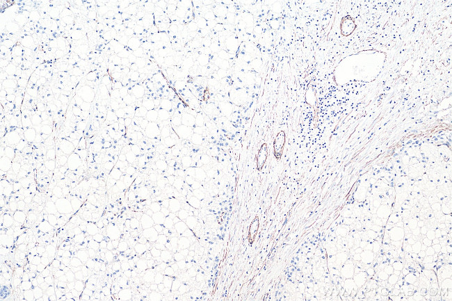 Alpha SMA Antibody in Immunohistochemistry (Paraffin) (IHC (P))