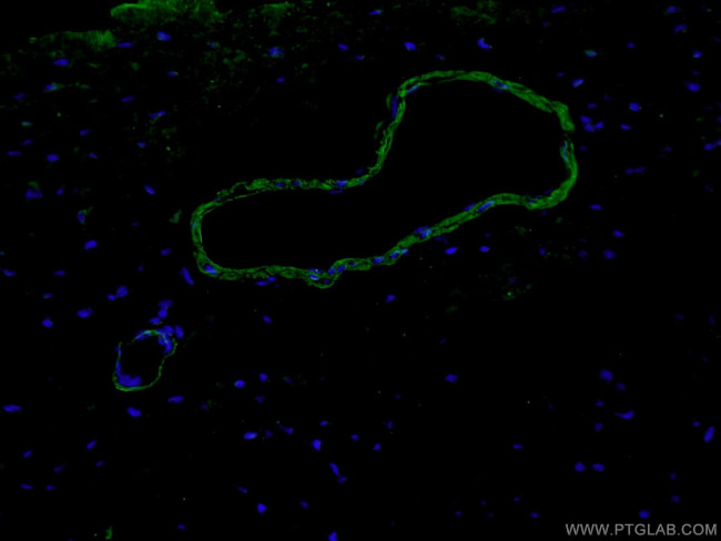 Alpha SMA Antibody in Immunohistochemistry (PFA fixed) (IHC (PFA))