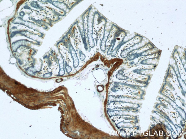 Alpha SMA Antibody in Immunohistochemistry (Paraffin) (IHC (P))