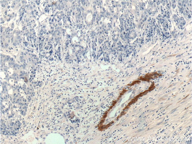 Alpha SMA Antibody in Immunohistochemistry (Paraffin) (IHC (P))