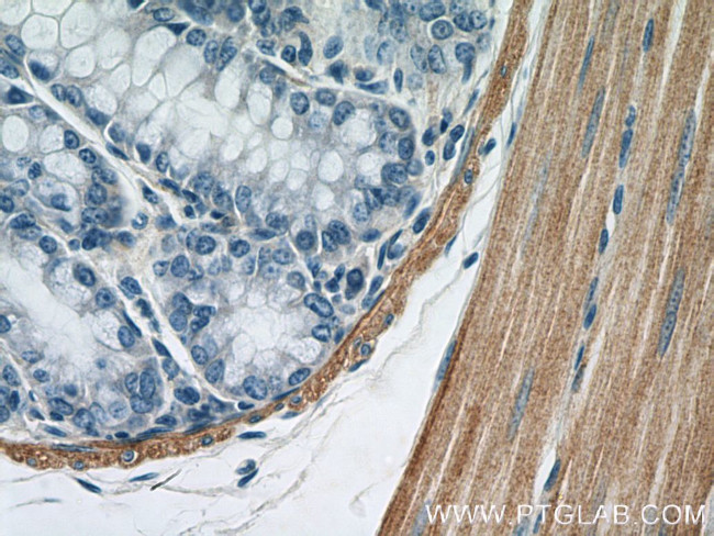 Alpha SMA Antibody in Immunohistochemistry (Paraffin) (IHC (P))