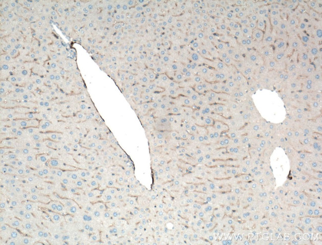 Alpha SMA Antibody in Immunohistochemistry (Paraffin) (IHC (P))