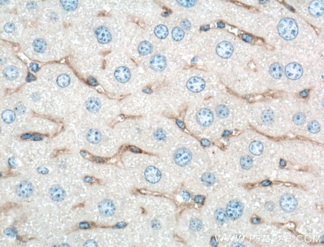 Alpha SMA Antibody in Immunohistochemistry (Paraffin) (IHC (P))