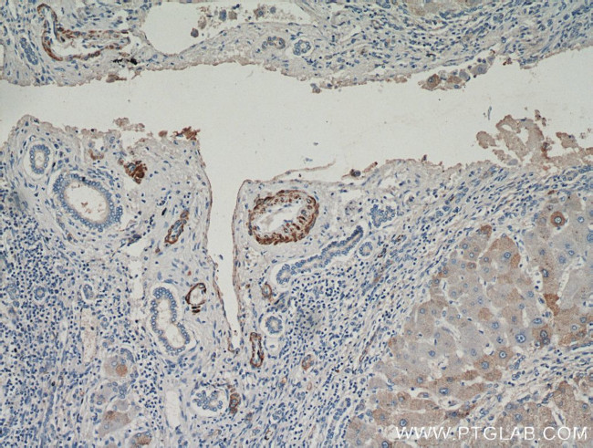 Alpha SMA Antibody in Immunohistochemistry (Paraffin) (IHC (P))