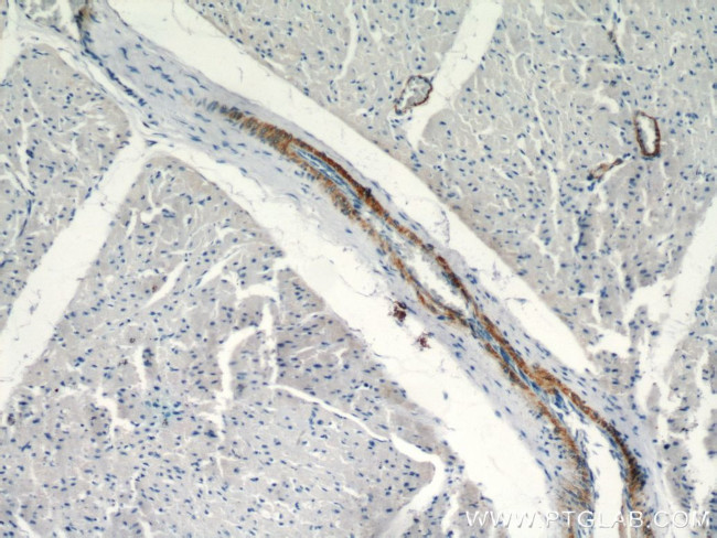 Alpha SMA Antibody in Immunohistochemistry (Paraffin) (IHC (P))