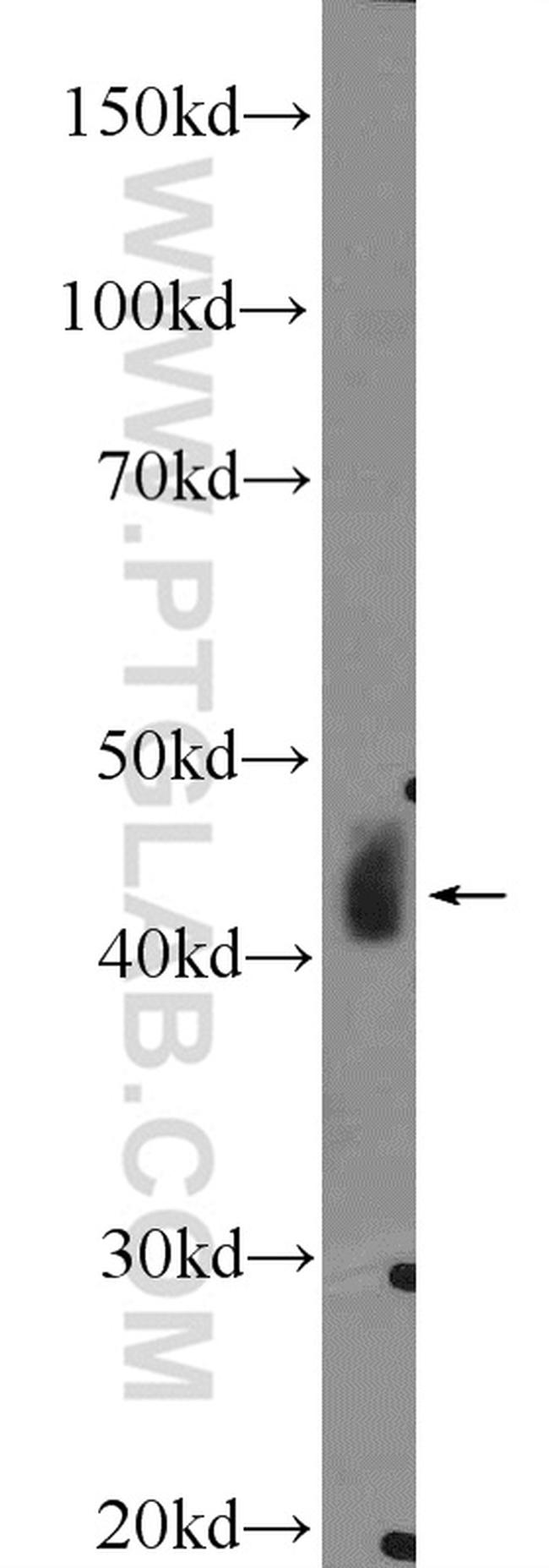 Alpha SMA Antibody in Western Blot (WB)