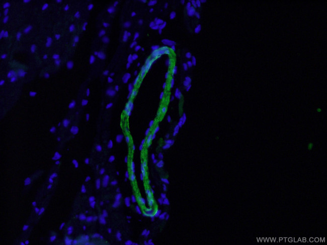 Alpha SMA Antibody in Immunohistochemistry (PFA fixed) (IHC (PFA))