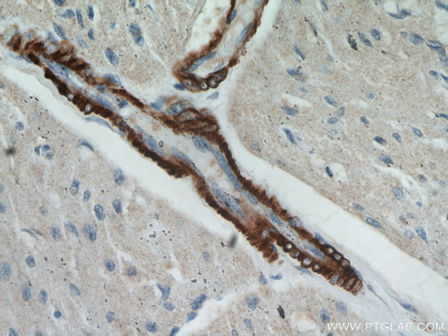 Alpha SMA Antibody in Immunohistochemistry (Paraffin) (IHC (P))