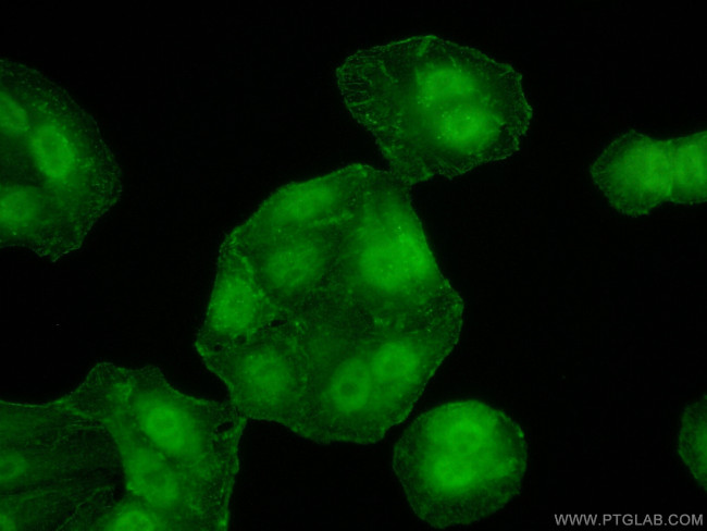 PPP1CB Antibody in Immunocytochemistry (ICC/IF)