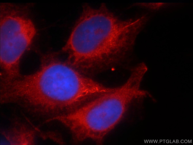 PRKG2 Antibody in Immunocytochemistry (ICC/IF)