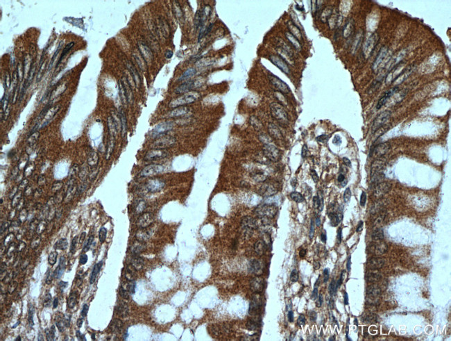 PRKG2 Antibody in Immunohistochemistry (Paraffin) (IHC (P))