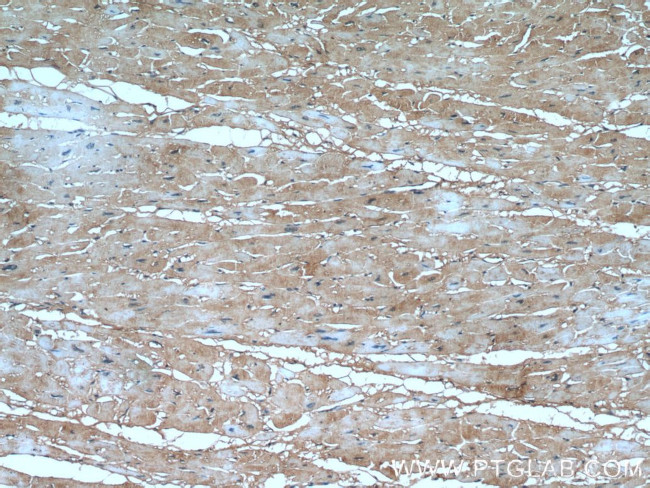 ARHGAP10 Antibody in Immunohistochemistry (Paraffin) (IHC (P))