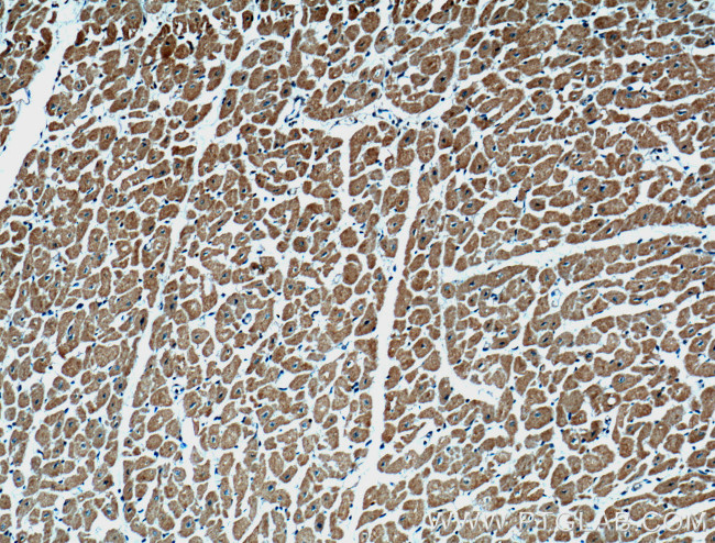 ARHGAP10 Antibody in Immunohistochemistry (Paraffin) (IHC (P))