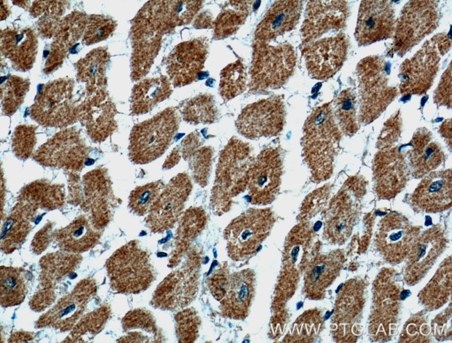 ARHGAP10 Antibody in Immunohistochemistry (Paraffin) (IHC (P))