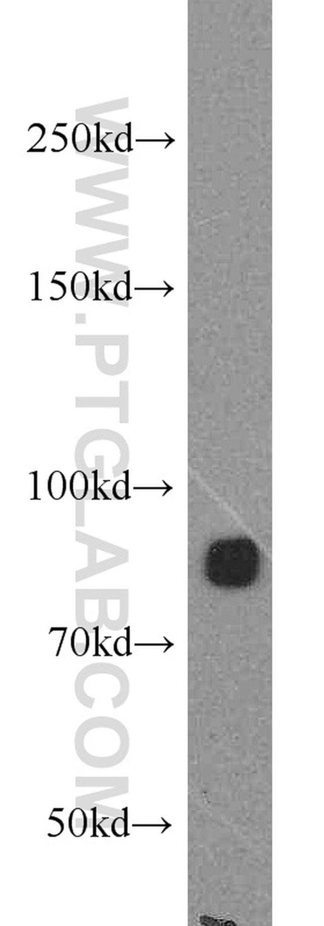 ARHGAP10 Antibody in Western Blot (WB)